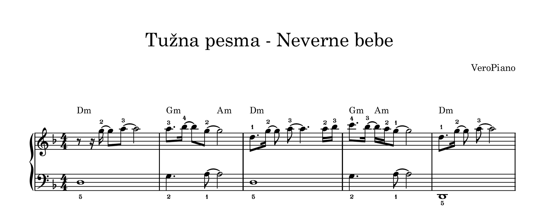 Tuzna pesma preview